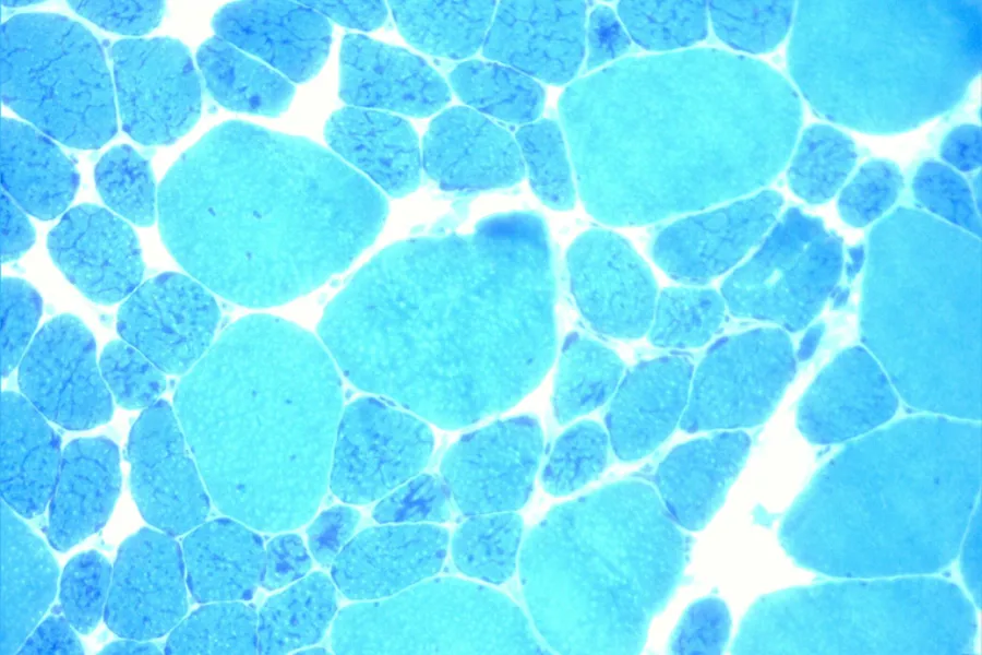 Et nærbilde av en blå flis