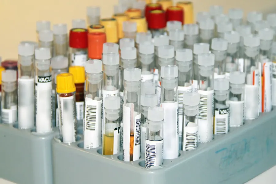 En gruppe flasker på en hylle