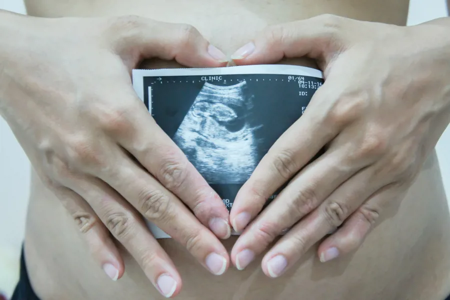 Gravis kvinne ultralydbilde
