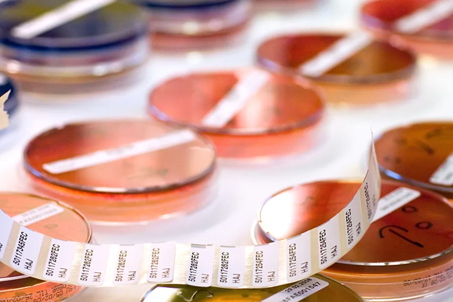 Et nærbilde av bakterieskåler