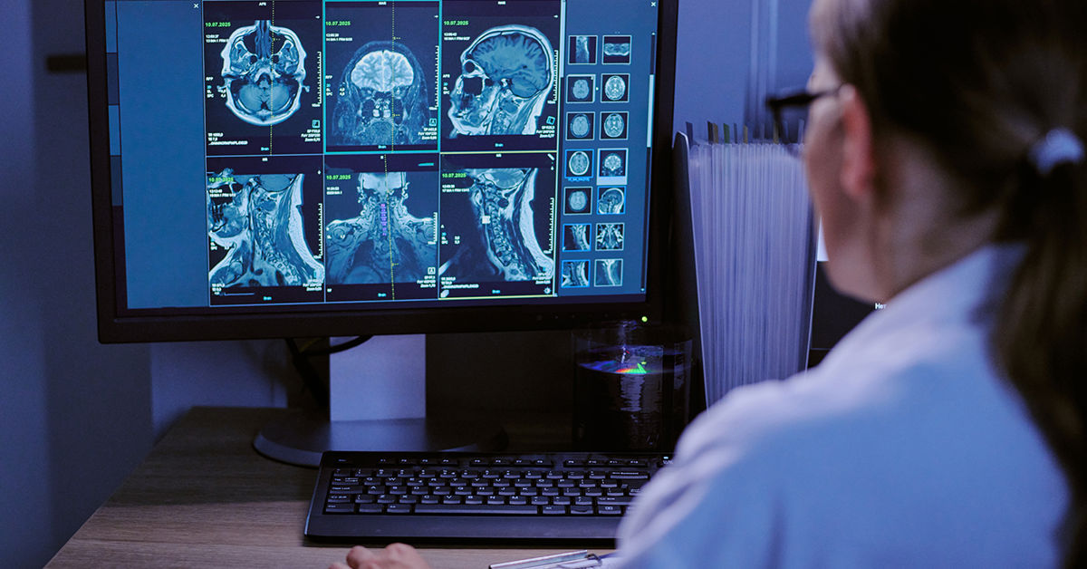 Sammen om radiologiske tjenester i Nord–Norge - Helse Nord RHF