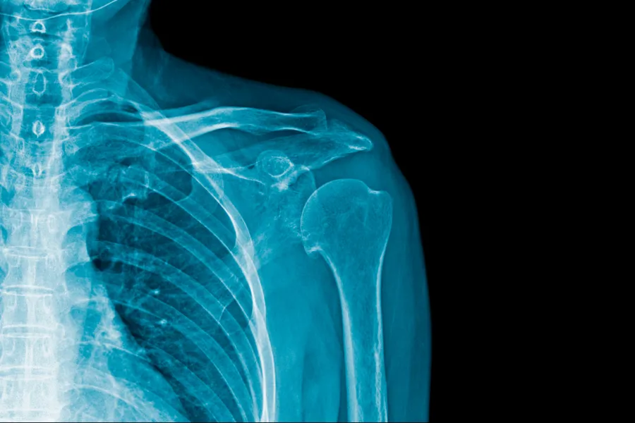 Et blått røntgenbilde av en menneskekropp